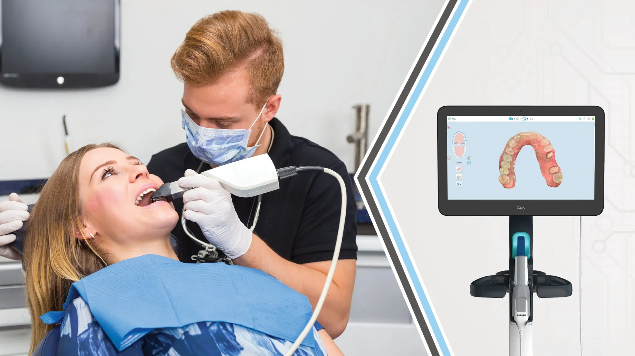 benefits of digital impressions in modern dentistry