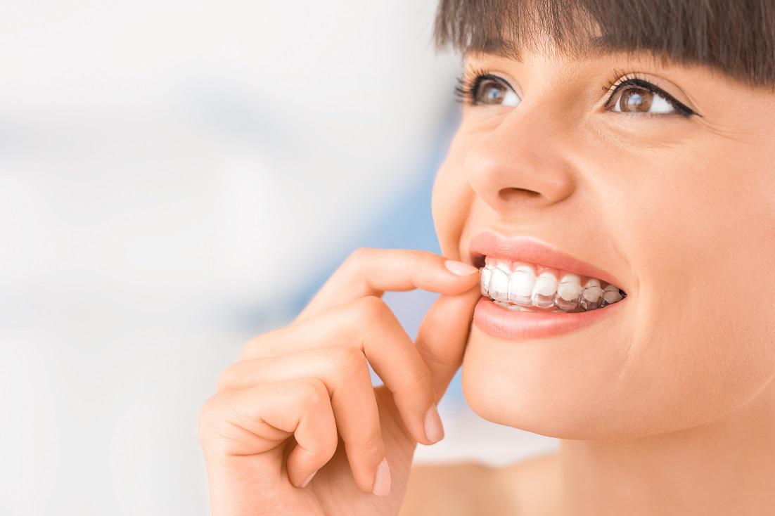 Invisalign for teens in Carstairs