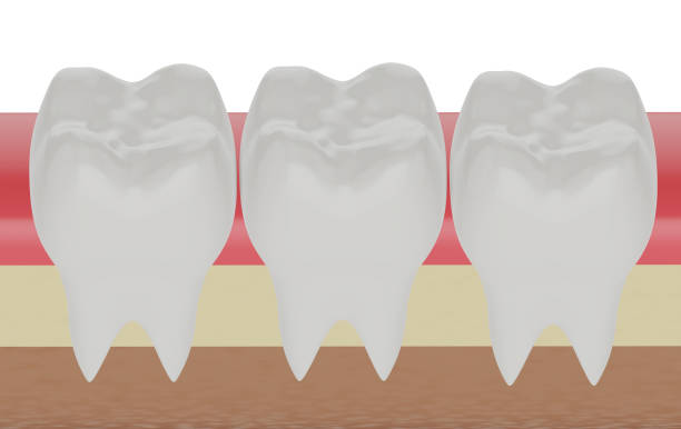 how plaque and tartar affect your oral health